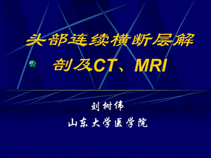 头部连续横断层解剖及CTMRI.ppt