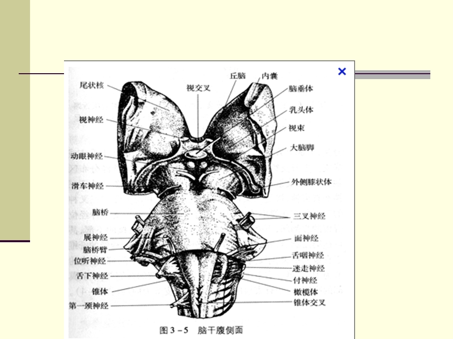 三叉神经解剖及MR表现.ppt_第2页