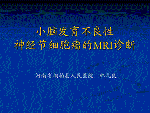 小脑发育不良性神经节细胞瘤的MRI表现.ppt