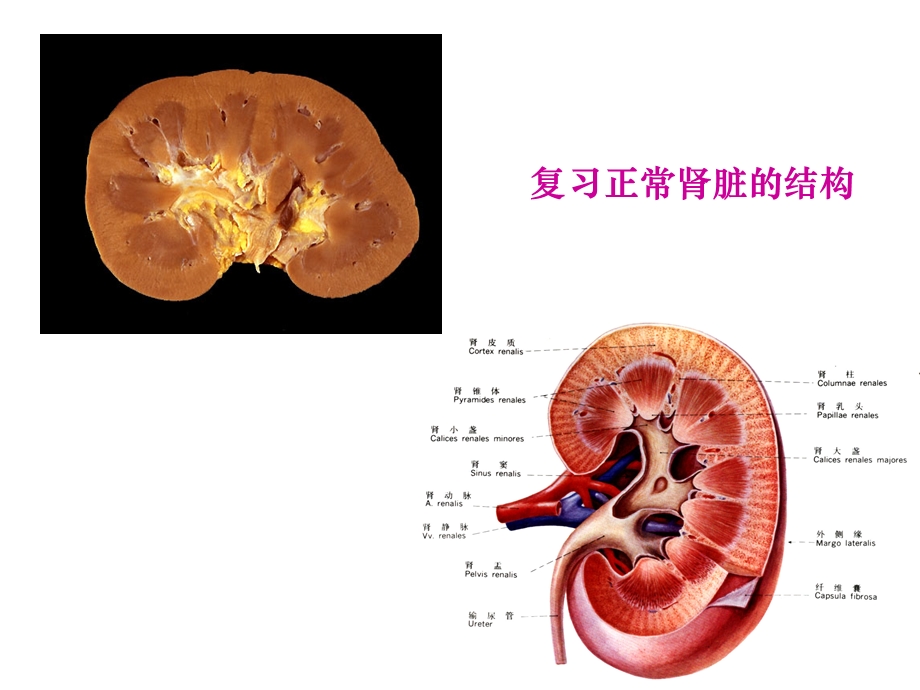 病理学肾小球肾炎(上部分).ppt_第3页