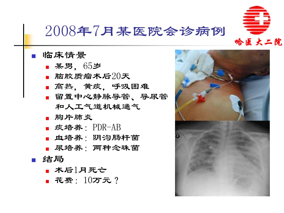 哈尔滨医科大学附属第二医院刘旭.ppt_第3页