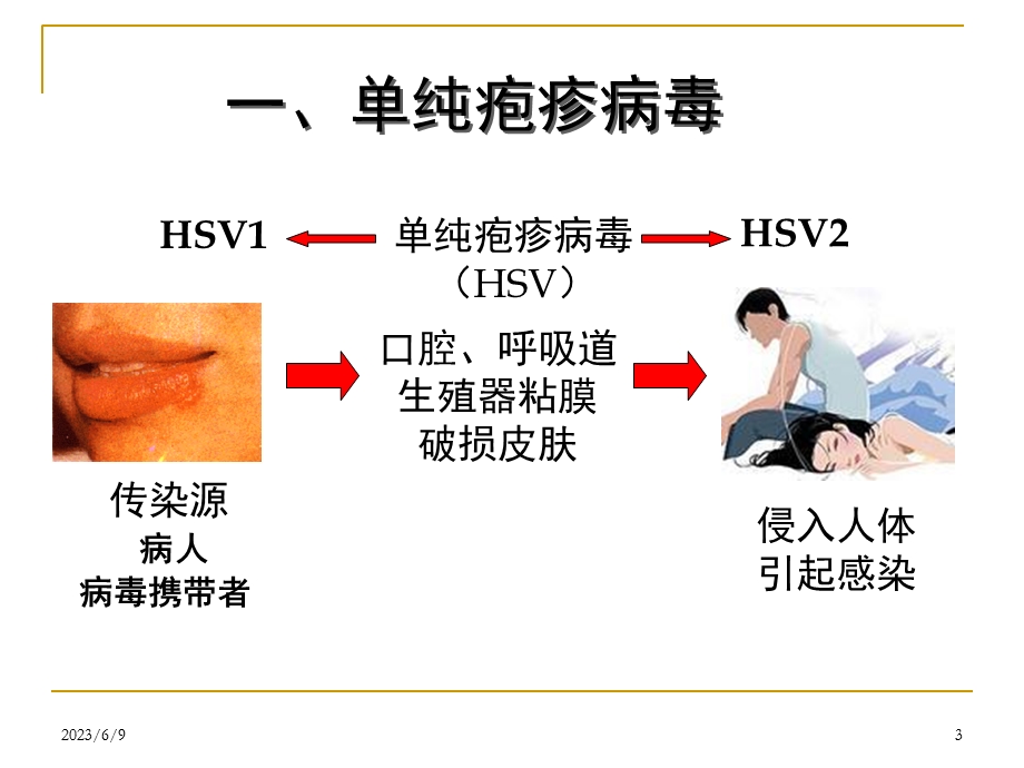 三十一章其它病毒及朊粒.ppt_第3页