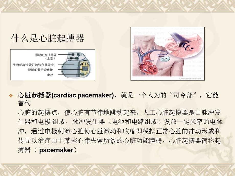 起搏器的护理.ppt_第2页