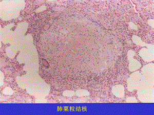 病理学实习镜下传染病.ppt