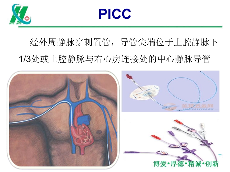 中心静脉导管留置期间疑难病例分享.ppt_第2页