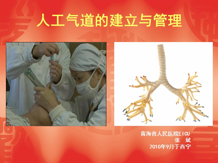 人工气道的建立与.ppt_第1页