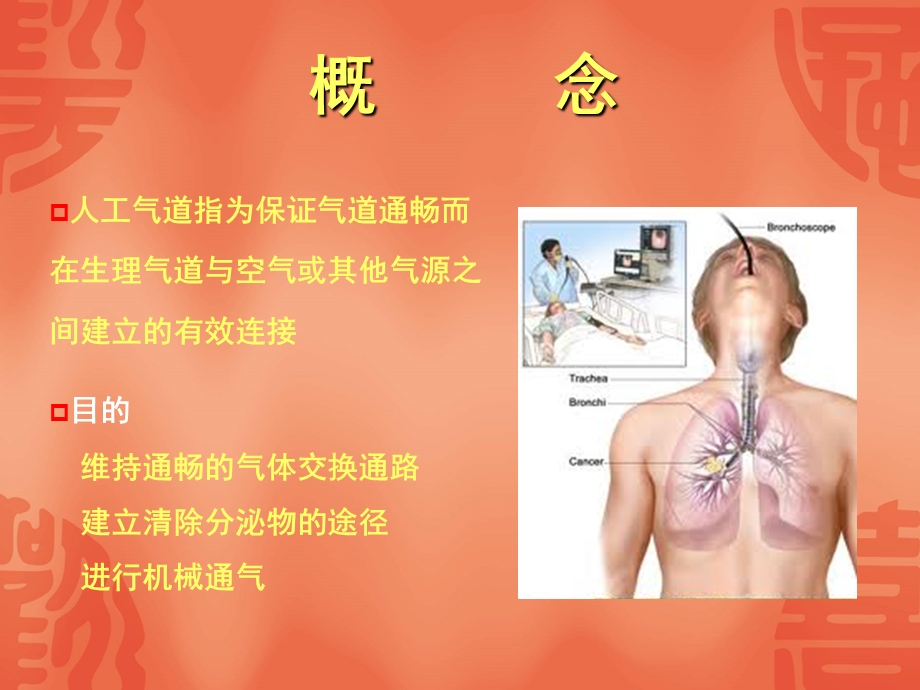 人工气道的建立与.ppt_第2页