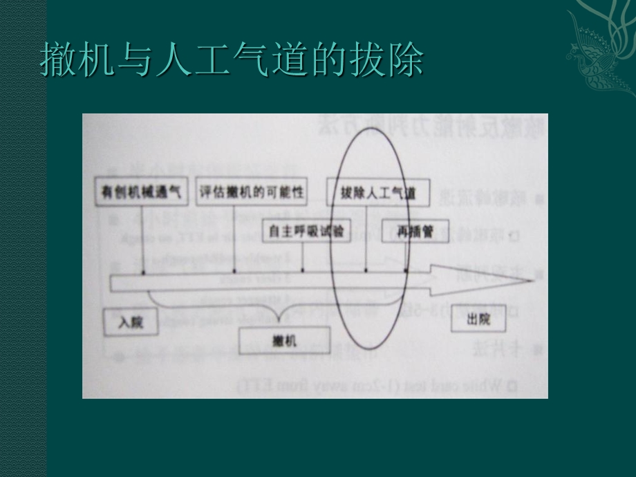 人工气道的拔除及意外脱.ppt_第2页