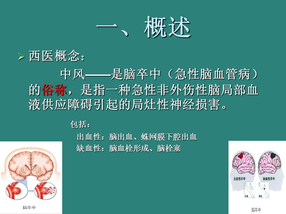 中风中医辨证论治.ppt_第3页