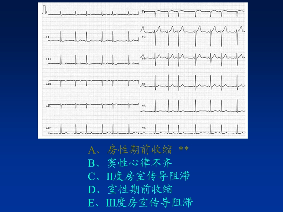 临床技能考试辅助检查结果判读.ppt_第3页