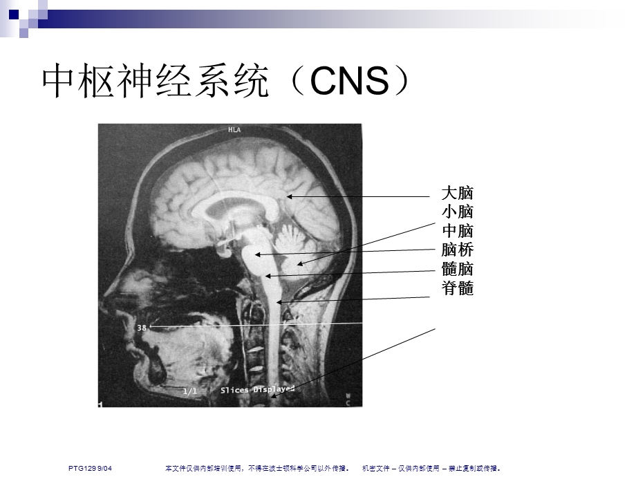 人脑和脑血管解剖分析(NXPowerLite).ppt_第3页