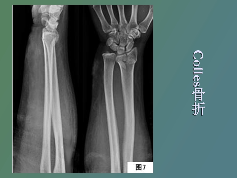 临床执业医师考试X线考点总结.ppt_第2页