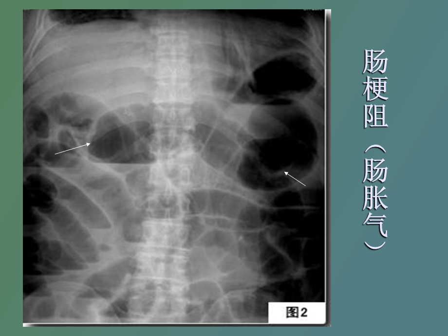 临床执业医师考试X线考点总结.ppt_第3页