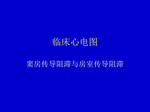 临床心电图窦房传导阻滞与房室传导阻滞.ppt