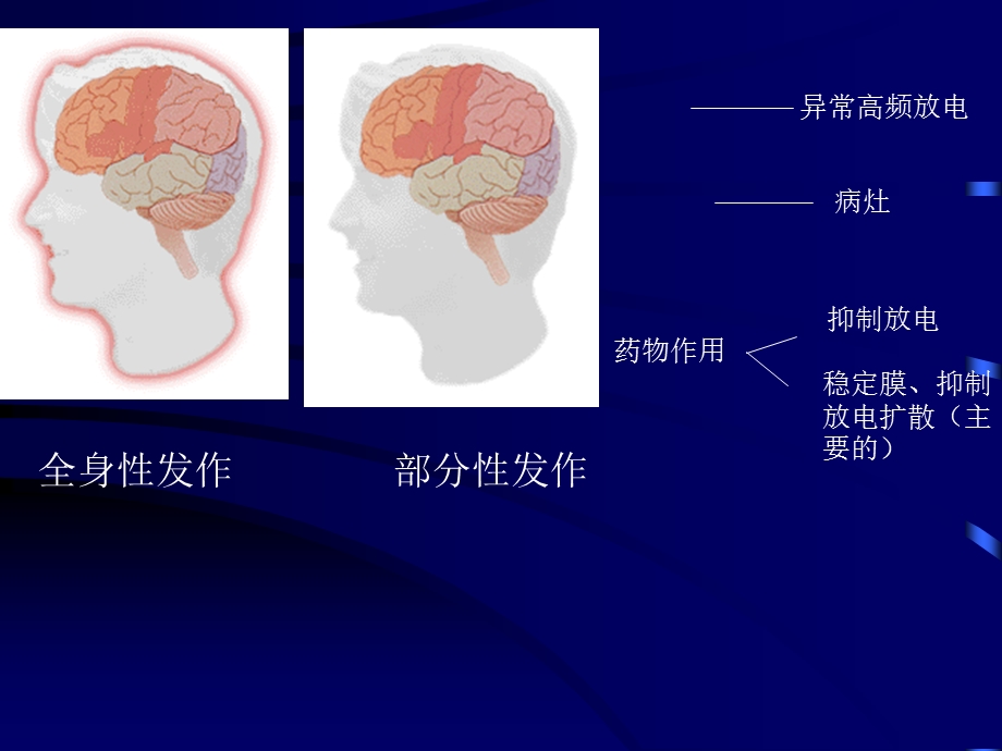 临本：第16章抗癫痫药及抗惊厥药.ppt_第3页