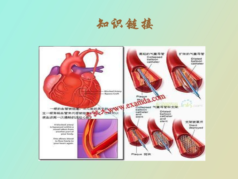 主动脉内球囊反搏术的基本原理蔡泽超.ppt_第3页