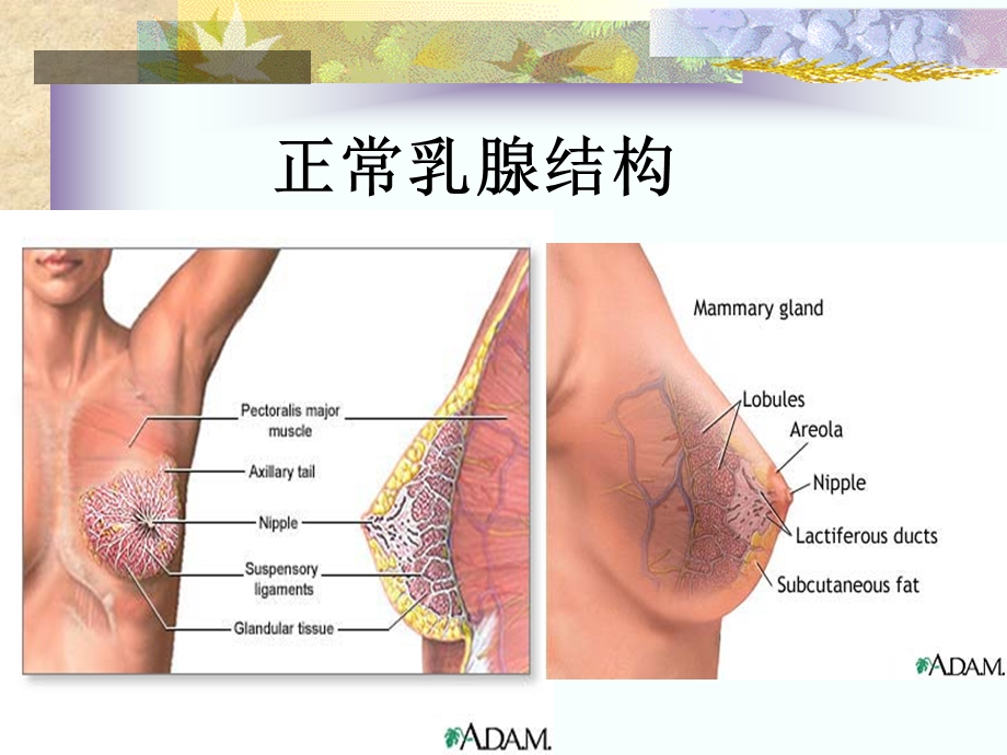 乳腺钙化的X线鉴别诊断.ppt_第2页