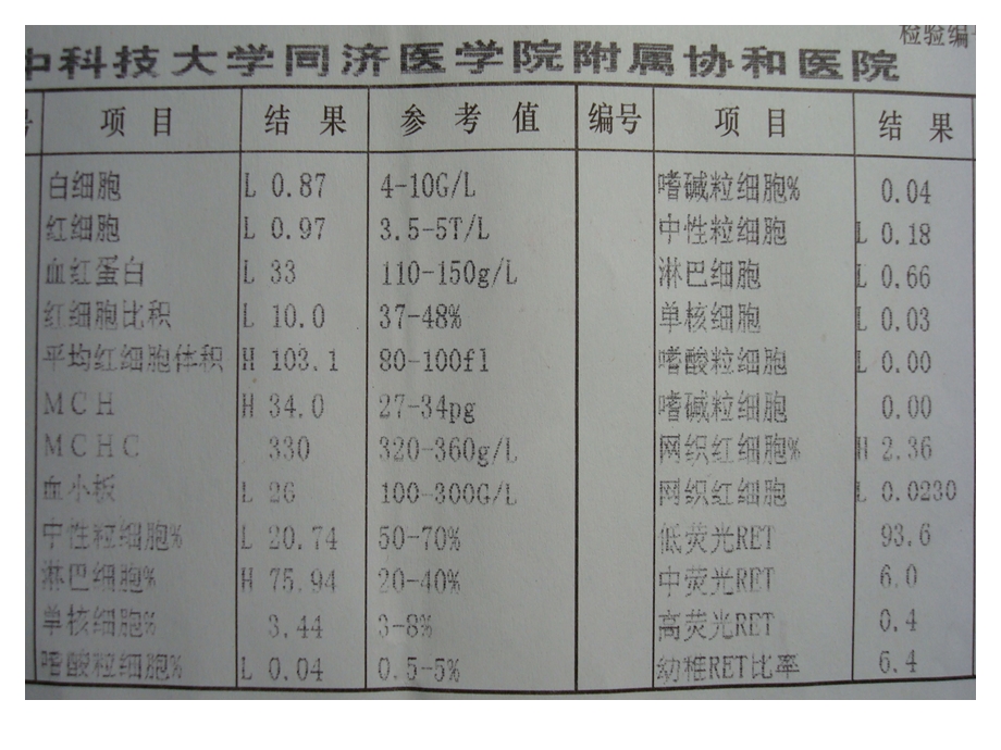 临床血液学和血液学检验-贫血(MA).ppt_第2页