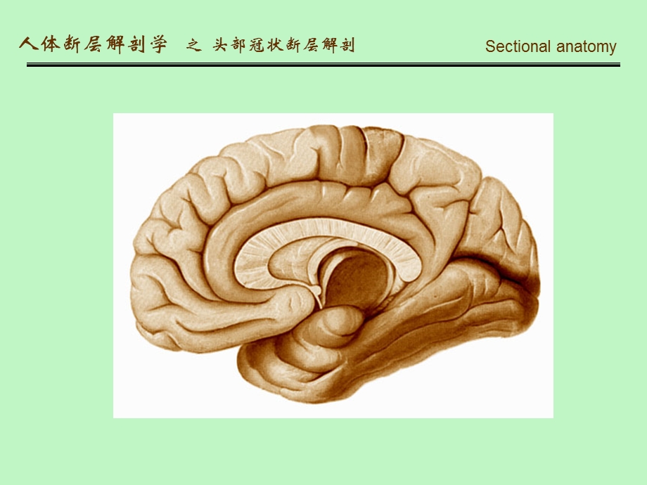 人体断面解剖学-头部冠状断层解剖.ppt_第3页