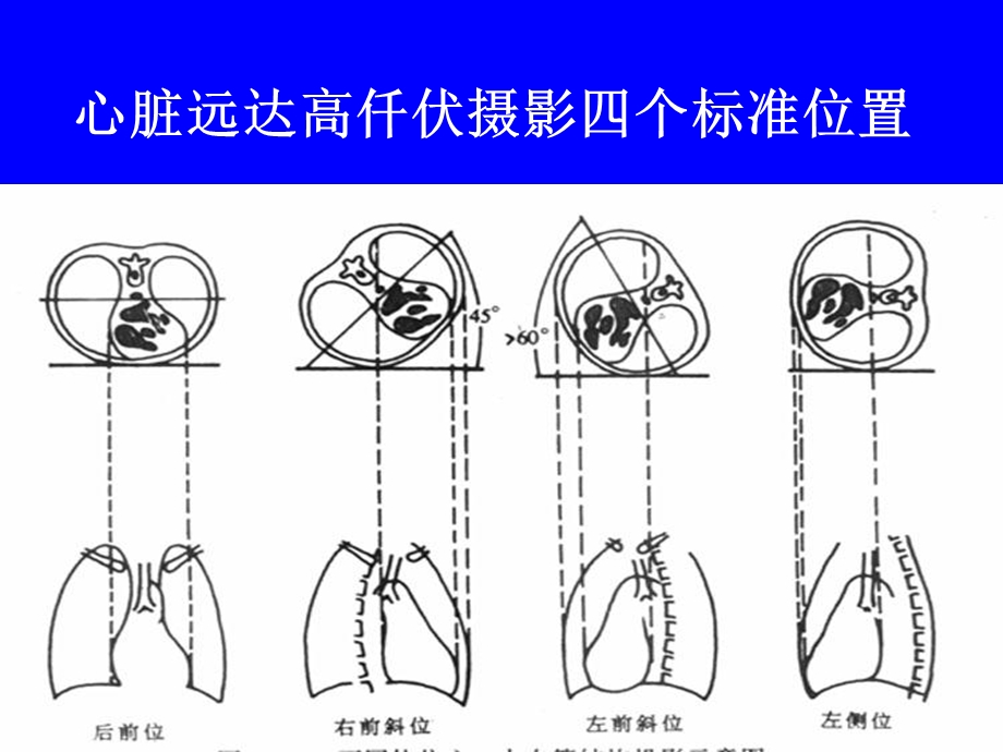 临床本科循环系统实习片库.ppt_第3页