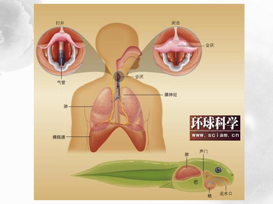 中枢顽固性呃逆.ppt_第3页