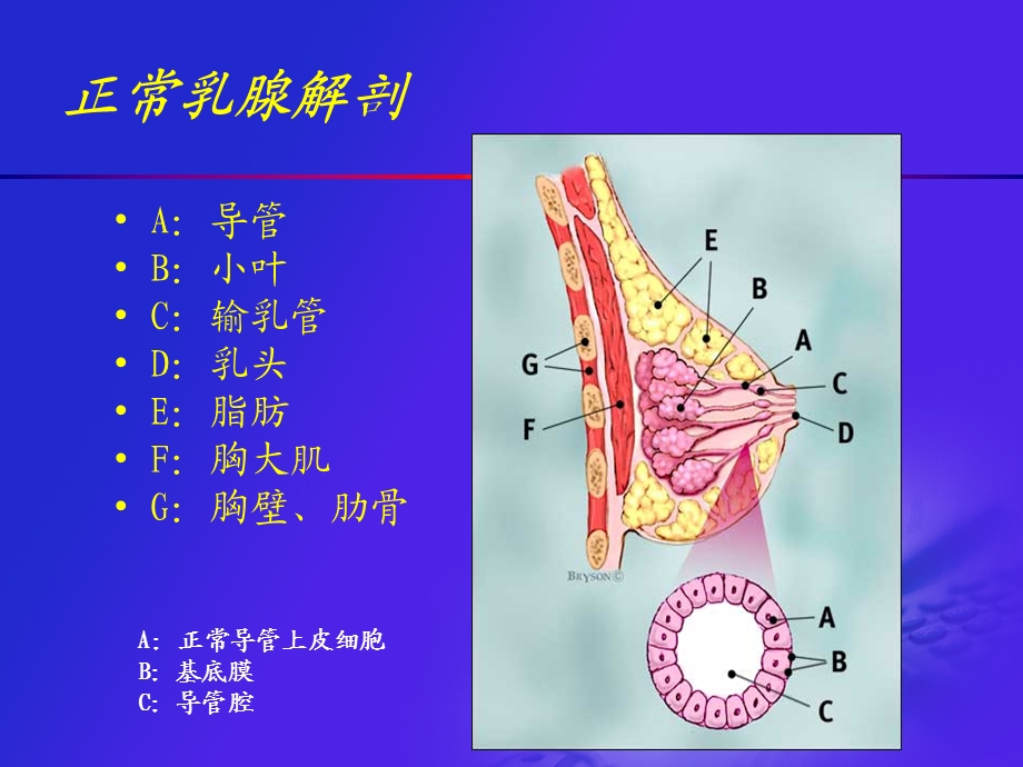 乳腺疾病超声诊断李凤华上海.ppt_第3页