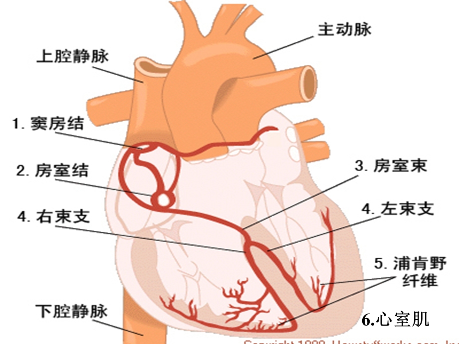 临床常见心律失常心电图波形.ppt_第3页