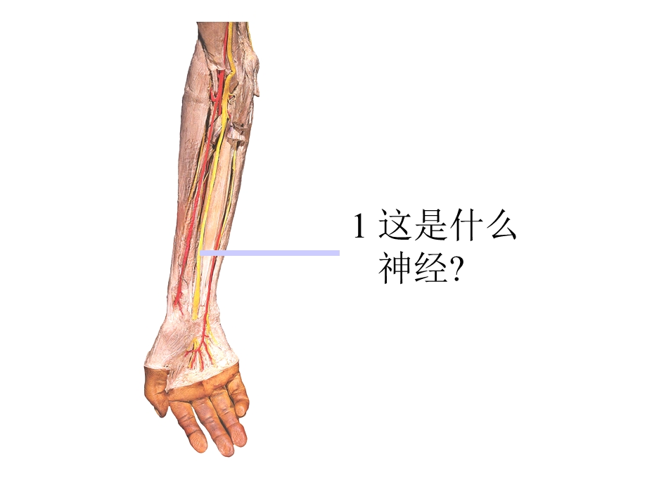 人体形态学标本考试#.ppt_第2页