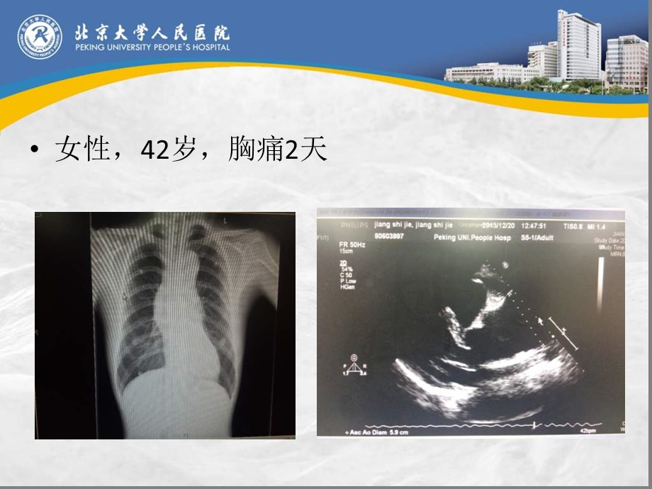 主动脉疾病的遗传倾向及基因变异.ppt_第2页