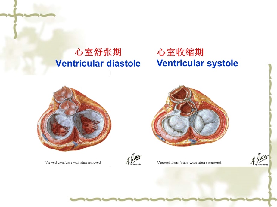 主动脉瓣置换术后的护理.ppt_第3页