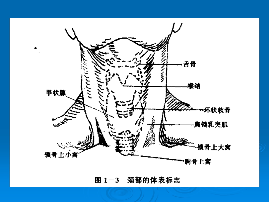 中心静脉穿刺的解剖.ppt_第3页