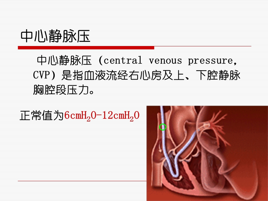 中心静脉压(CVP)监测.ppt_第3页