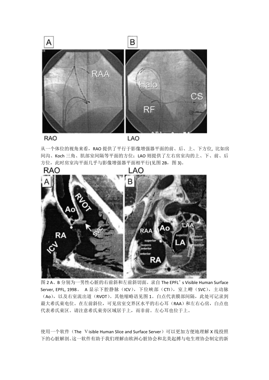 【2019年整理】心脏射频消融术的X线解剖定位.doc_第2页