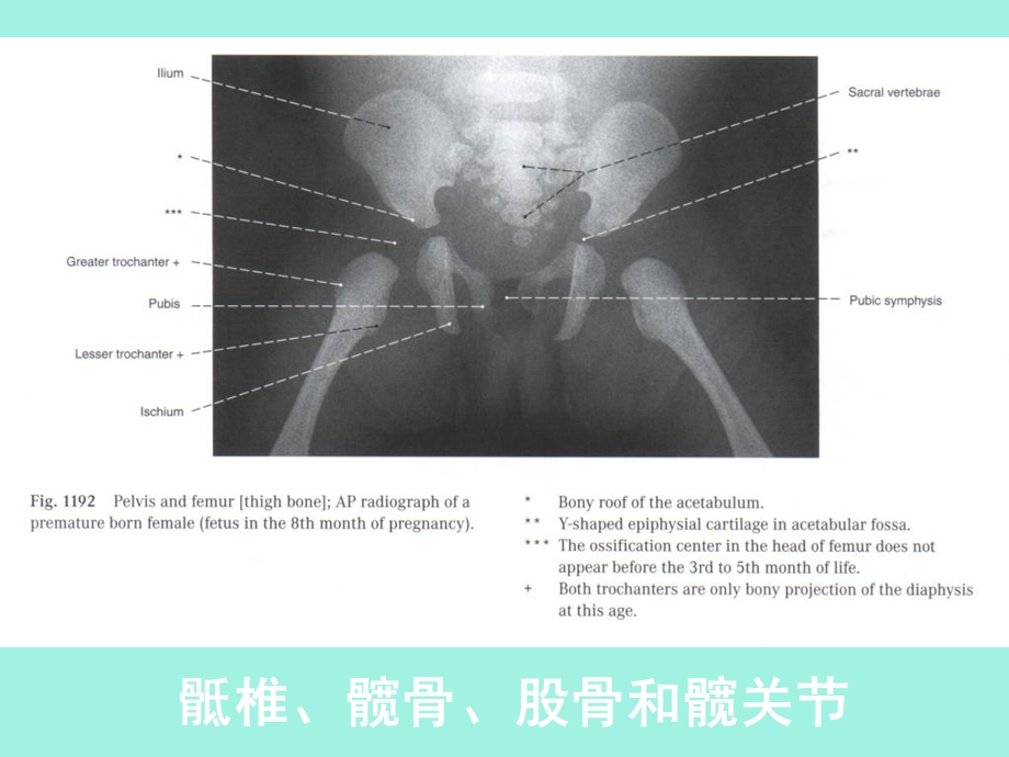 人体断层解剖学-下肢的断层解剖.ppt_第3页