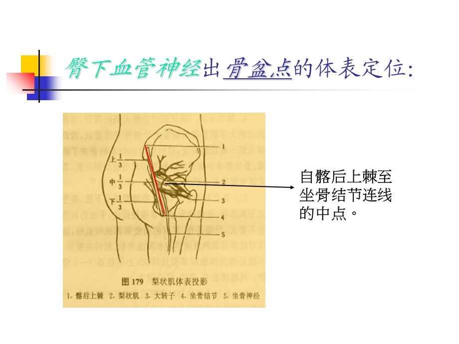 体表定位学之腰臀部.ppt_第3页