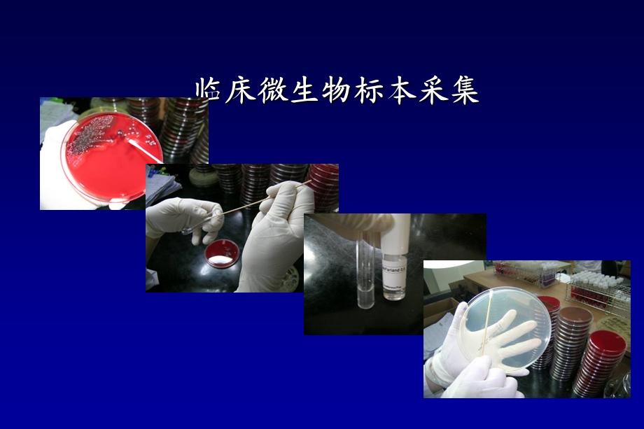 临床微生物标本采集.ppt_第1页