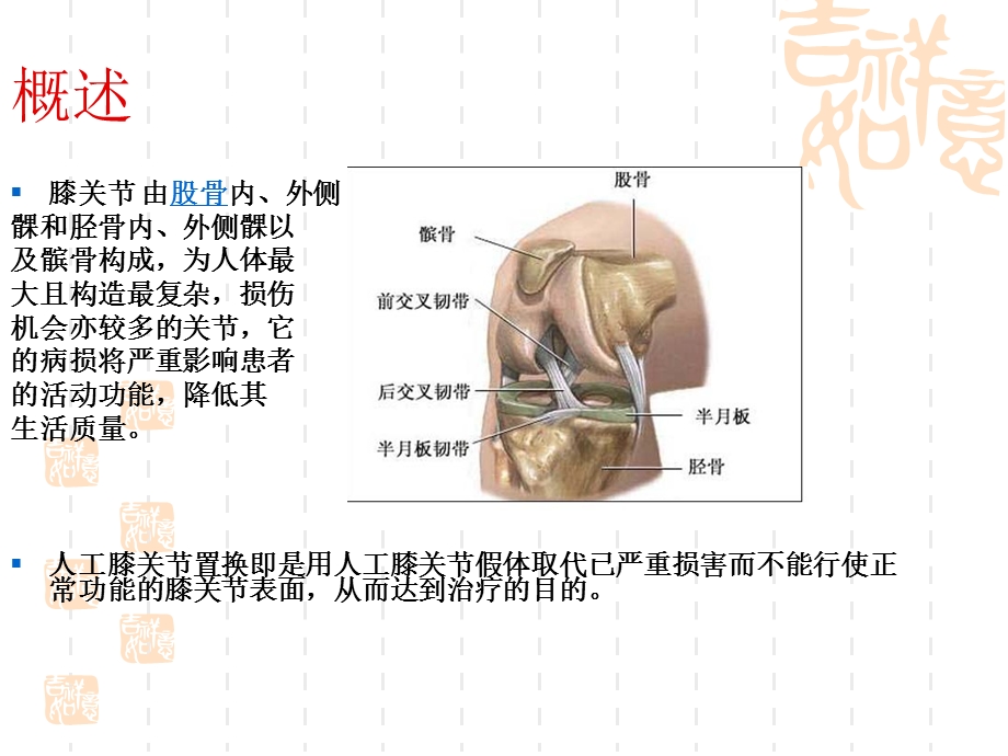人工膝关节置换的护理.ppt_第2页