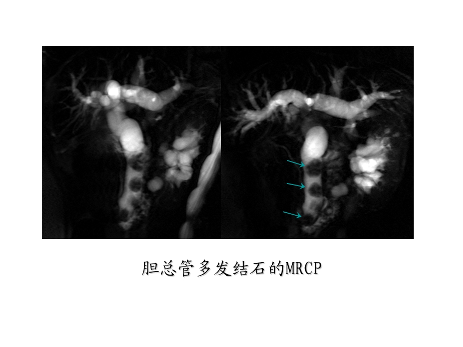 临床医学影像检查6.ppt_第2页