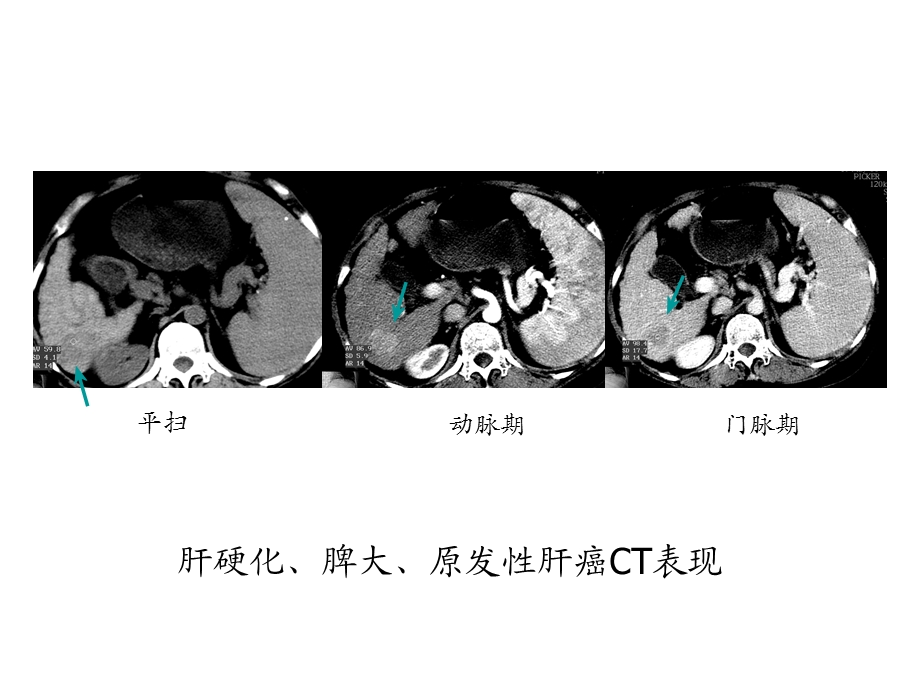 临床医学影像检查6.ppt_第3页