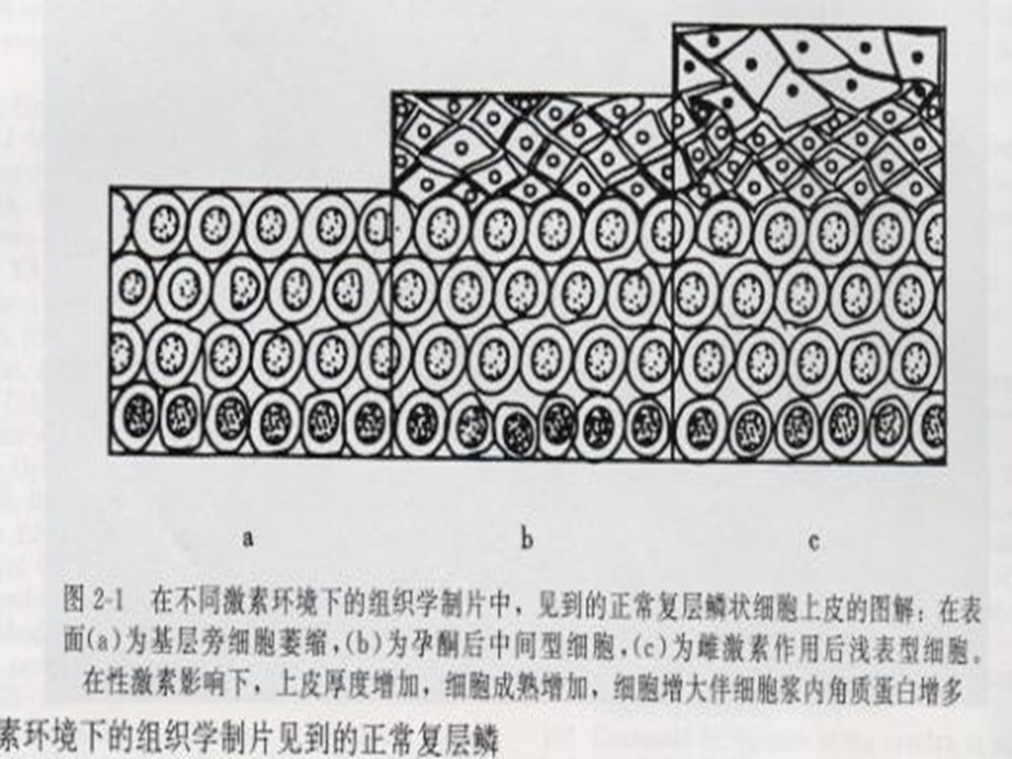 临床妇科病理联系.ppt_第3页