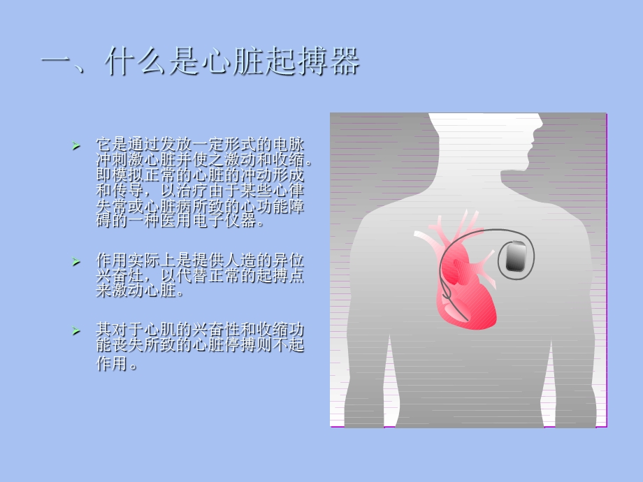 人工心脏起搏器.ppt_第3页