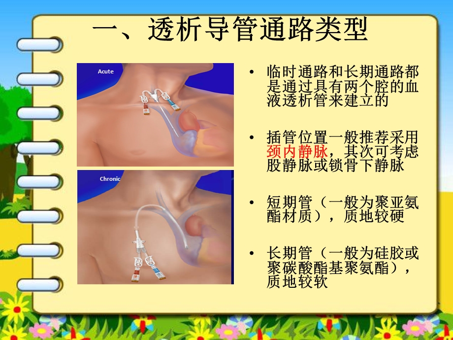 临时和长期中心静脉置管.ppt_第2页