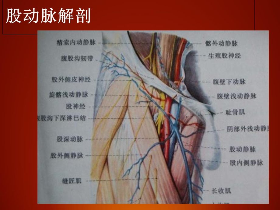 介入股动脉穿刺术.ppt_第3页