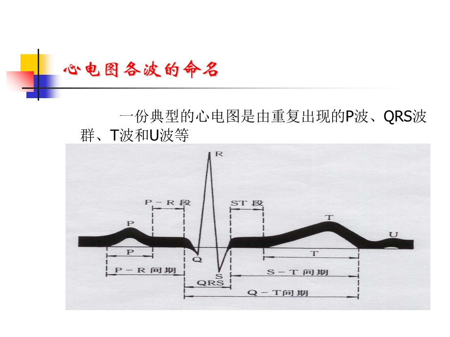 临床常见心电图的判读.ppt_第2页