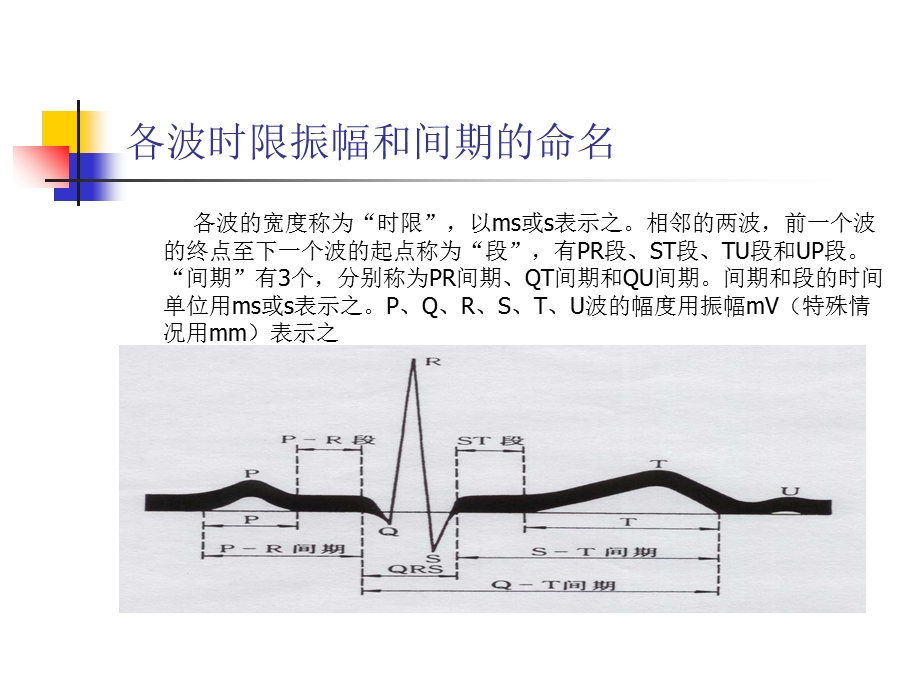 临床常见心电图的判读.ppt_第3页