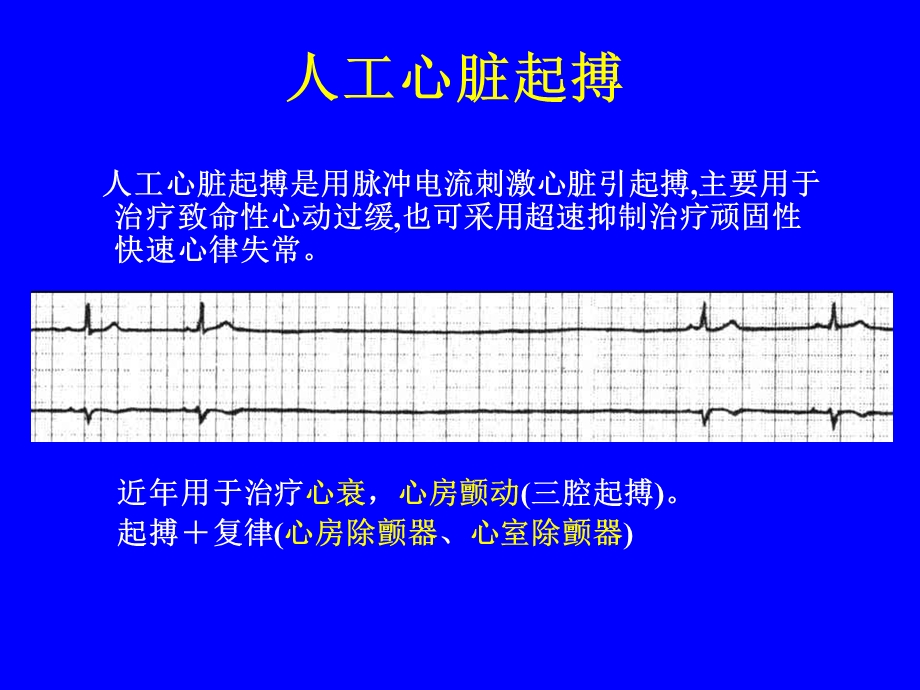 人工心脏起搏03417ppt.ppt_第1页