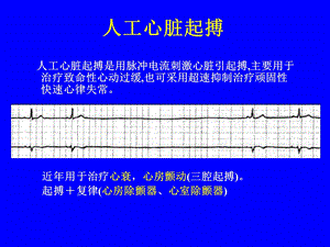 人工心脏起搏03417ppt.ppt