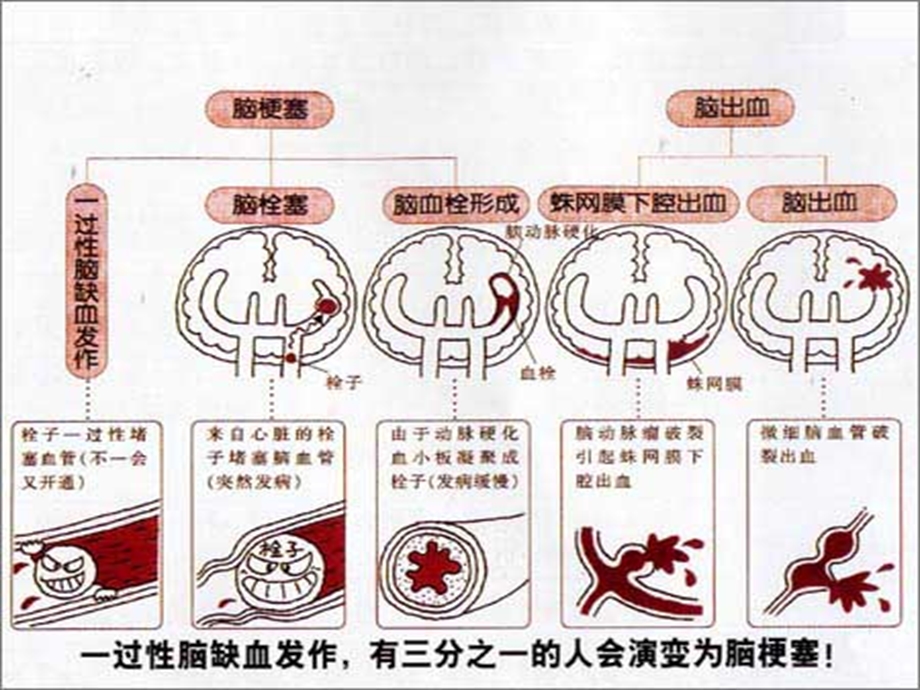 中风历节病脉证并治第五.ppt_第3页