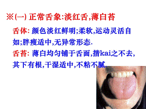 中医诊断学_-_舌诊图谱.ppt