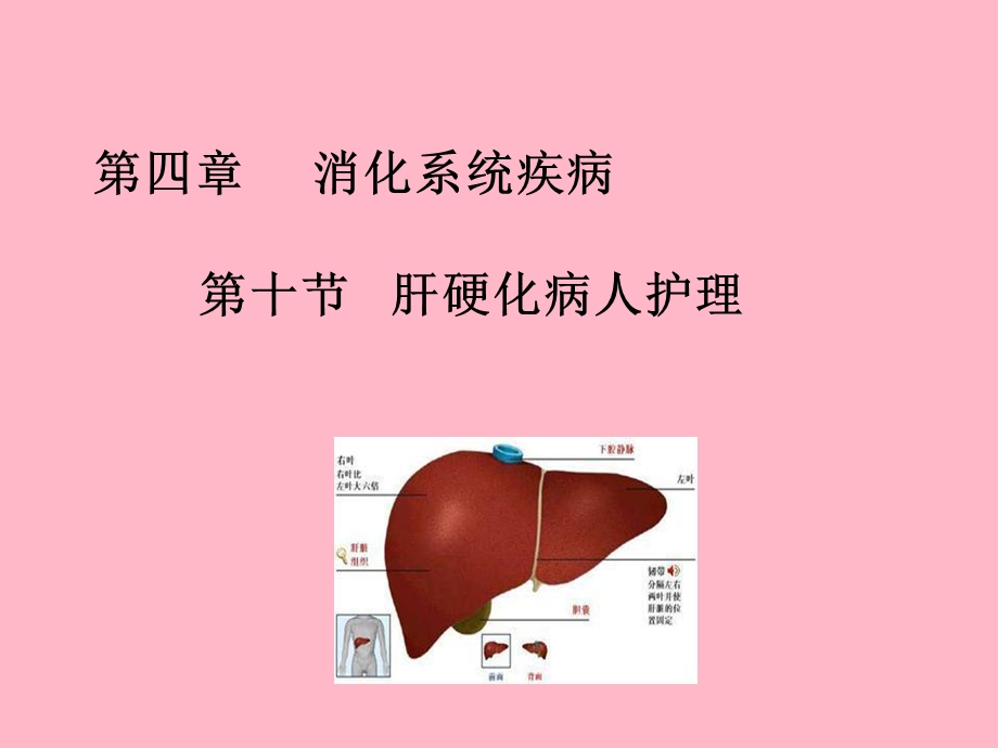 内科护理学课肝硬化.ppt_第1页